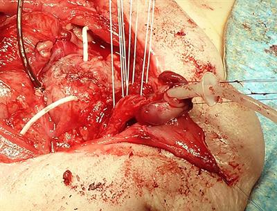 Recent Trends in the Management of Bladder Exstrophy: The Gordian Knot Has Not Yet Been Cut